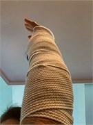 002-Susan_Splint