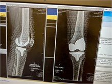 08-Knee_Surgery